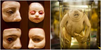 Korku Bağımlıları İçin: Tüylerinizi Diken Diken Edecek En İlginç 11 Müze