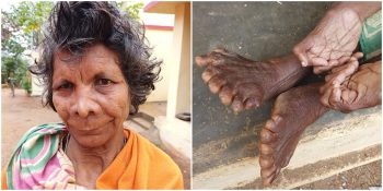 “Cadı” Diye Yaftalanarak Toplumdan Dışlanan 31 Parmaklı Kumari Nayak