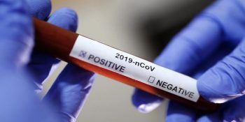Grip Kadar Tehlikeli Olmadığı Düşünülen Corona Virüsü Hakkında Son Gelişmeler