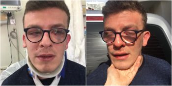 Otizimli Genç Alper Taha Behrem’i “Engelleyim Vurma!” Dediği Halde Darp Eden Okan Metin