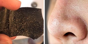 Siyah nokta temizleme bandı nasıl kullanılır