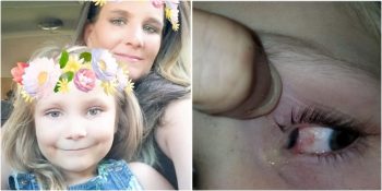 Gözündeki Acıyla Uyandıktan Sonra Gözünde Böcek Olduğu Fark Edilen 6 Yaşındaki SibiKaia Monk