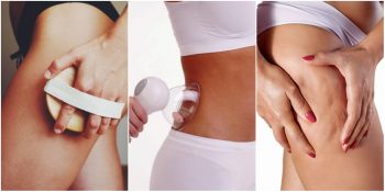 Dermatologlardan Selülit Görünümünü Azaltmak İsteyenlere Tavsiyeler