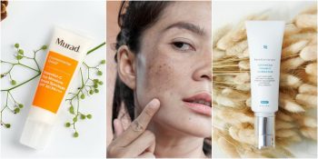 Güneş Lekelerine Elveda! Gönül Rahatlığıyla Kullanabileceğiniz En Etkili Leke Giderici Ürün Önerileri