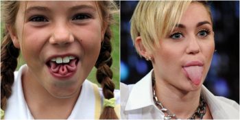 Vücudumuzun En Tuhaf Organı: Dil ile İlgili Duyunca Şaşıracağınız 8 Bilgi