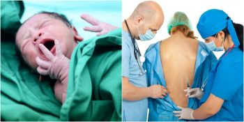 Kafanızda Soru İşareti Kalmasın: 5 Maddede Epidural ve Spinal Anestezi Arasındaki Farklar