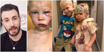 Sevgi Cesaret İster: Kardeşini Kurtarırken Yaralanan ve Yüzüne 90’dan Fazla Dikiş Atılan 6 Yaşındaki Bridger Walker