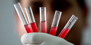 Altın Kan: Dünyada Sadece 43 Kişide Bulunan En Nadir Kan Grubu