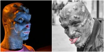 Burnunu Aldırdı! Uzaylı Gibi Görünmek İçin Yüzüne Çeşitli Modifiyeler Yapan Anthony Loffredo