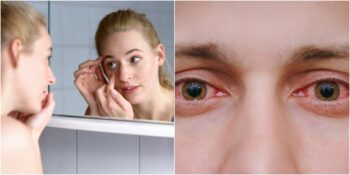 Gözünüze Bir Şey Kaçtığında Ne Yapmalısınız? Gözünüze Kaçan Şeyi Güvenle Çıkarmanın 7 Yolu