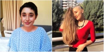 İkinci Kez Kansere Yakalanan 23 Yaşındaki Ayyüce Çınar Yaşam Savaşını Kaybetti