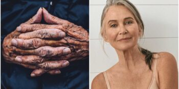 İsteseniz de Saklayamazsınız! Vücudunuzda Gerçek Yaşınızı Ele Veren 7 Bölge