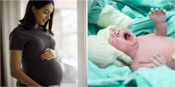 Sezaryen Hakkında Cevabı En Çok Merak Edilen 5 Soru