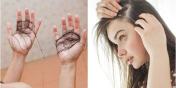 Saçlarınızın Normalden Daha Fazla Dökülüp Dökülmediğini Anlamanın 7 Yolu