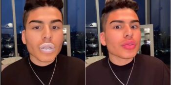 Sıradışı TikTok Trendi: Ereksiyon Kremiyle Dudaklarını Dolgunlaştıran TikTok Kullanıcıları