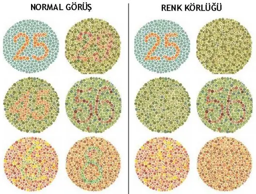 Renk Körlüğü Testi