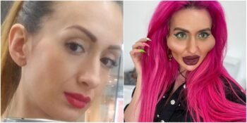 Dünyanın En Büyük Elmacık Kemiklerine Sahip Olan Ukraynalı Model Anastasia Pokreshchuk