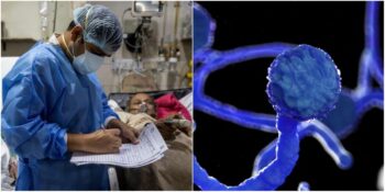 Hindistan’da “Kara Mantar” Krizi: Yeni Bir Salgın Mı Başlıyor?