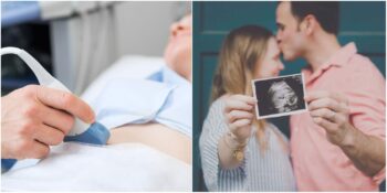 En Heyecanlı Bekleyiş: Hamilelikte Ultrason Muayenesi Nasıl Yapılır?