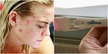 Toplanın Açıklıyoruz! Düzenli Olarak Işıklar Açık Uyursanız Ne Olur?