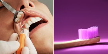 Gülüş Tasarımı: Evde Diş Beyazlatma Yöntemleri Hakkında Bilmeniz Gerekenler