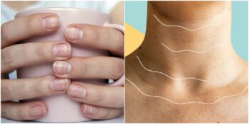 Hepsinin Bir Anlamı Var! Vücudunuzu Daha İyi Anlayabilmek İçin Bilmeniz Gerekenler