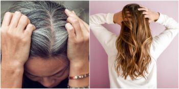 Toplanın Açıklıyoruz! Stres Yüzünden Oluşan Beyaz Saçları Yok Etmenin Yolları