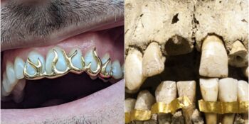 4500 Yıllık Bir Moda Anlayışı: Diş Mücevherlerinin Kadim Tarihi