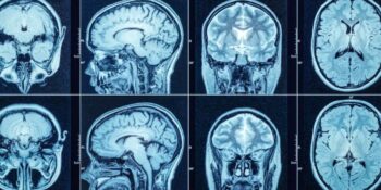 Bilim İnsanları Beynin Klitorisle Bağlantılı Olan Bölgesini Tespit Etti