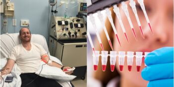 Kök Hücre Bağışı Nedir? Kimler Kök Hücre Bağışında Bulunabilir?