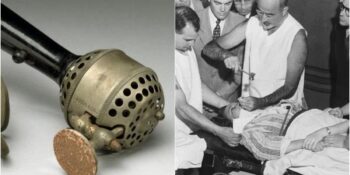 Vibratörlerden Sahte Yılan Yağlarına: Tarihteki En Çirkin Tıbbi Tedavi Yöntemleri