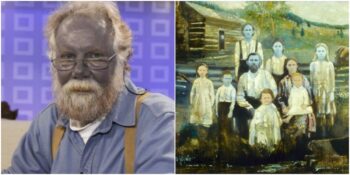 Gerçek Şirinler! Kentucky’de Yaşayan Mavi Tenli Fugate Ailesi Hakkında Bilmeniz Gerekenler