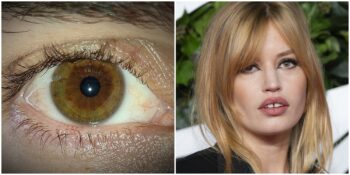 Dünyada Çok Az Kişinin Sahip Olduğu Nadir Görülen 12 Fiziksel Özellik