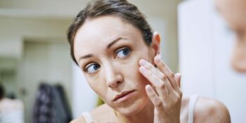 Pürüzsüz Bir Cilt İçin: 5 Adımda Sivilce İzleri Nasıl Geçer?