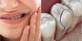 Toplanın Açıklıyoruz! Kahvaltıdan Hemen Sonra Dişlerinizi Fırçalarsanız Ne Olur?