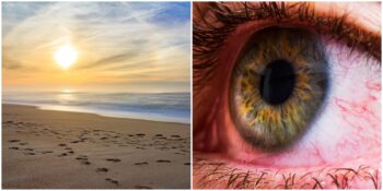 Yaz Aylarında Göz Sağlığını Tehdit Eden Unsurlar ve Korunma Yöntemleri