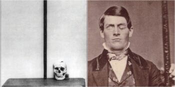 Kafatasına Bir Metrelik Demir Çubuk Saplandıktan Sonra Hayatta Kalmayı Başaran Phineas Gage’in İnanılmaz Hikayesi