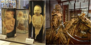 Hastalıkların Korkutucu Tarihine Yolculuk: Dünyadaki En İlginç 10 Tıp Müzesi
