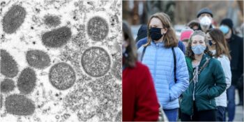 Uzmanlar Açıkladı! Maymun Çiçeği Virüsü Cinsel Yolla Mı Bulaşıyor?