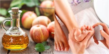 Aspirinden Kabartma Tozuna: Ayak Nasırlarından Kolayca Kurtulmanızı Sağlayacak 9 Şey