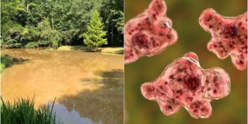 Nadir, Korkutucu, Ölümcül! Beyin Yiyen Amip Nedir, Belirtileri Nelerdir?