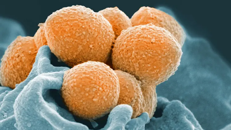 strep a