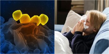 Strep A Enfeksiyonu: Türkiye Olası Bir Salgına Hazır Mı?