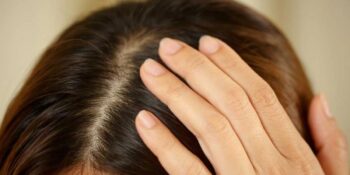 Toplanın Açıklıyoruz! Kepek Nedir, Neden Oluşur Ve Nasıl Geçer?