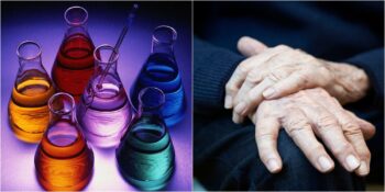 2017 Yılında İstanbul’da Kanalizasyona Dökülen Bir Kimyasal Maddenin Parkinson Hastalığına Neden Olabileceği Tespit Edildi