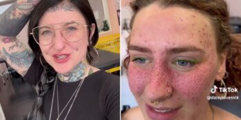 Milyonlarca Kişiyi Etkisi Altına Alan TikTok’un Yeni Trendi: Kalıcı Çil Dövmesi Yaptırmak