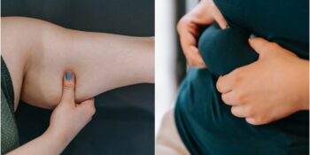 Vücudun Farklı Bölgelerindeki Yağlar Sağlığımız Hakkında Ne Söylüyor?