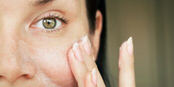 Hepimizin Ortak Problemi! Cilt Gözenekleri Nasıl Sıkılaşır, Gözenekler Kapanır Mı?