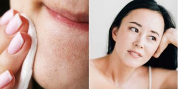 Siyah Noktalara Elveda! Sosyal Medyanın Yeni Cilt Bakım Trendi Fiddy Metodu Nedir?