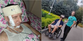 Rüyalarını Kontrol Edebilmek İçin Matkapla Kafatasını Delen Adam: Michael Raduga